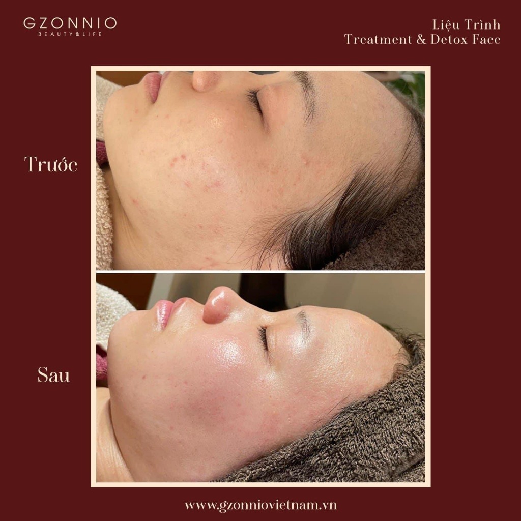 Treatment Serum