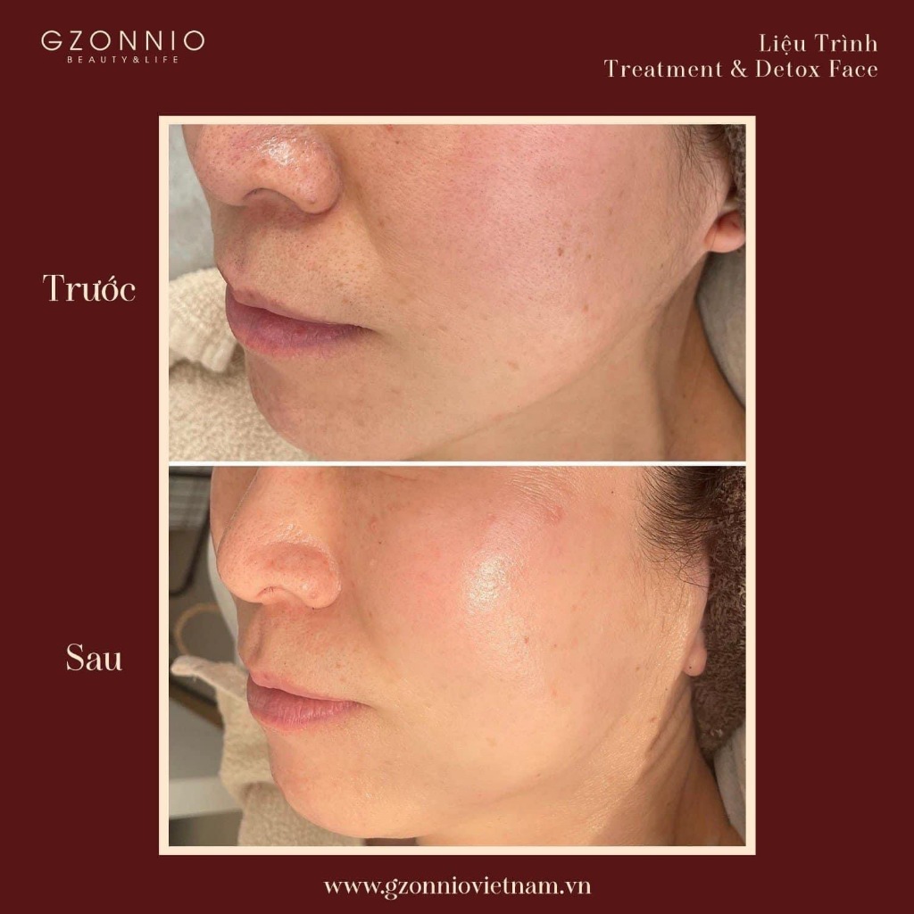 Treatment Serum