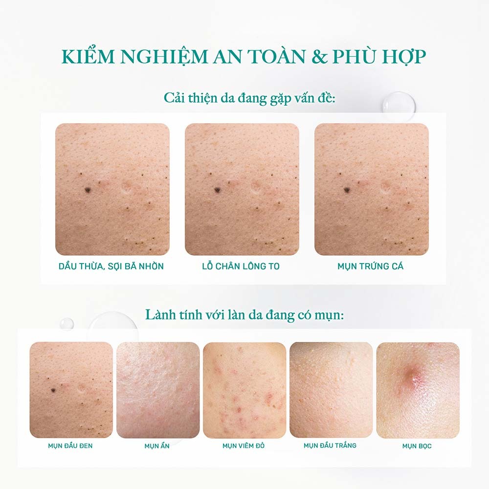 Ảnh Tẩy Trang Thuần Chay Sạch Dịu Êm Cho Da Dầu Mụn Derladie Cleansing Water Witch Hazel Micellar Unsented 500ML 1