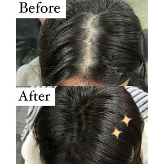 Dầu gội , xả thảo dược chống rụng tóc Klorane