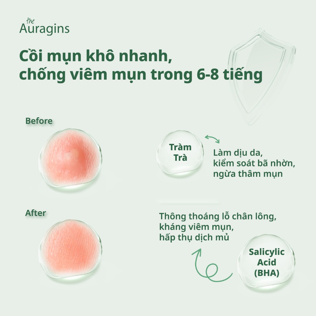 Ảnh Miếng dán mụn The Auragins Acne Rescue Patch 2