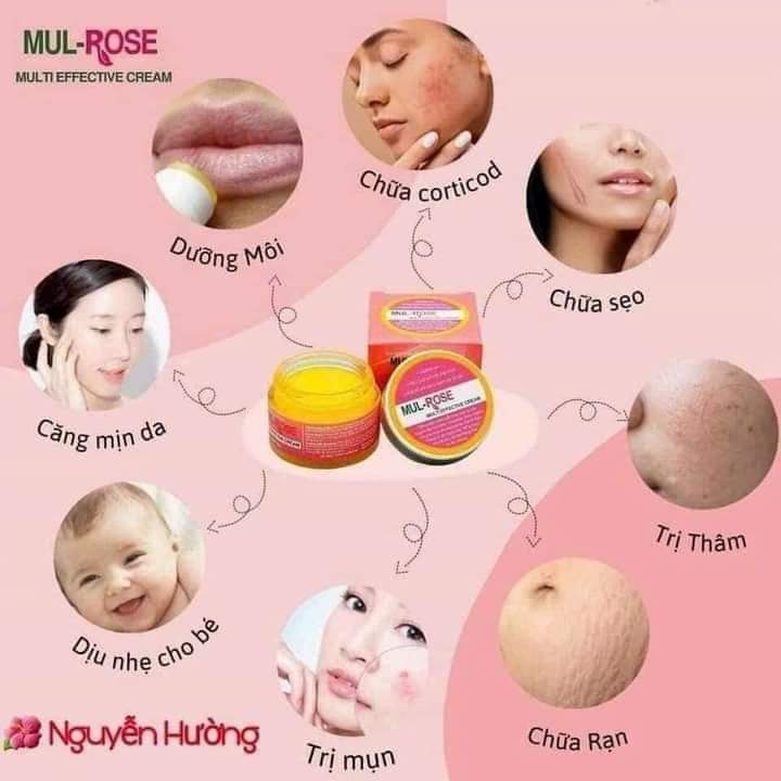 Ảnh Kem Nghệ Đa Năng Mulrose 30g 1