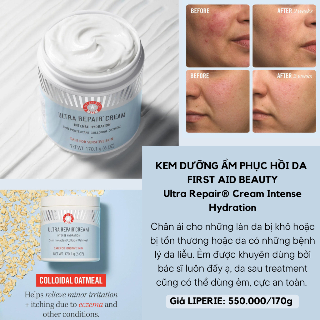 [First Aid Beauty] Kem dưỡng ẩm First Aid Beauty Ultra Repair® Cream