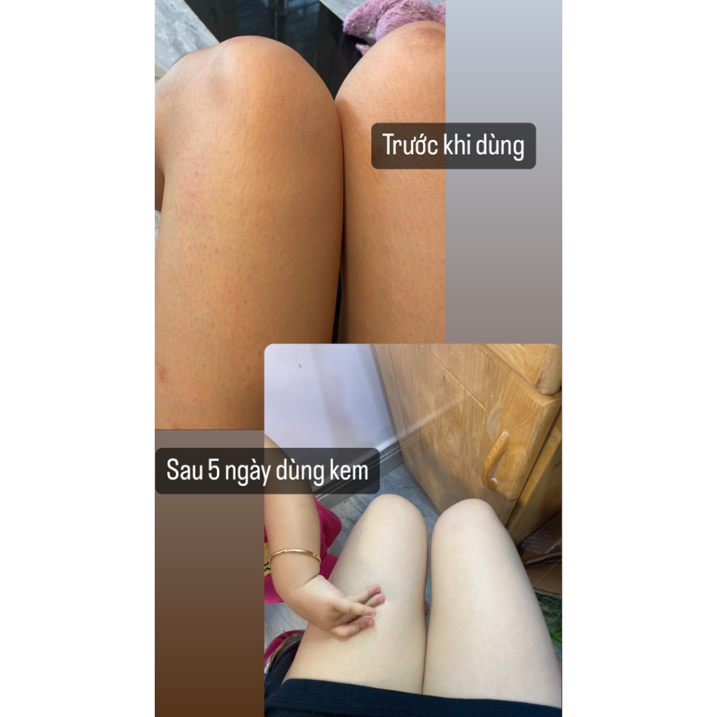Kem Body Trắng Da Dưỡng Ẩm An Toàn Krysie Loveskin