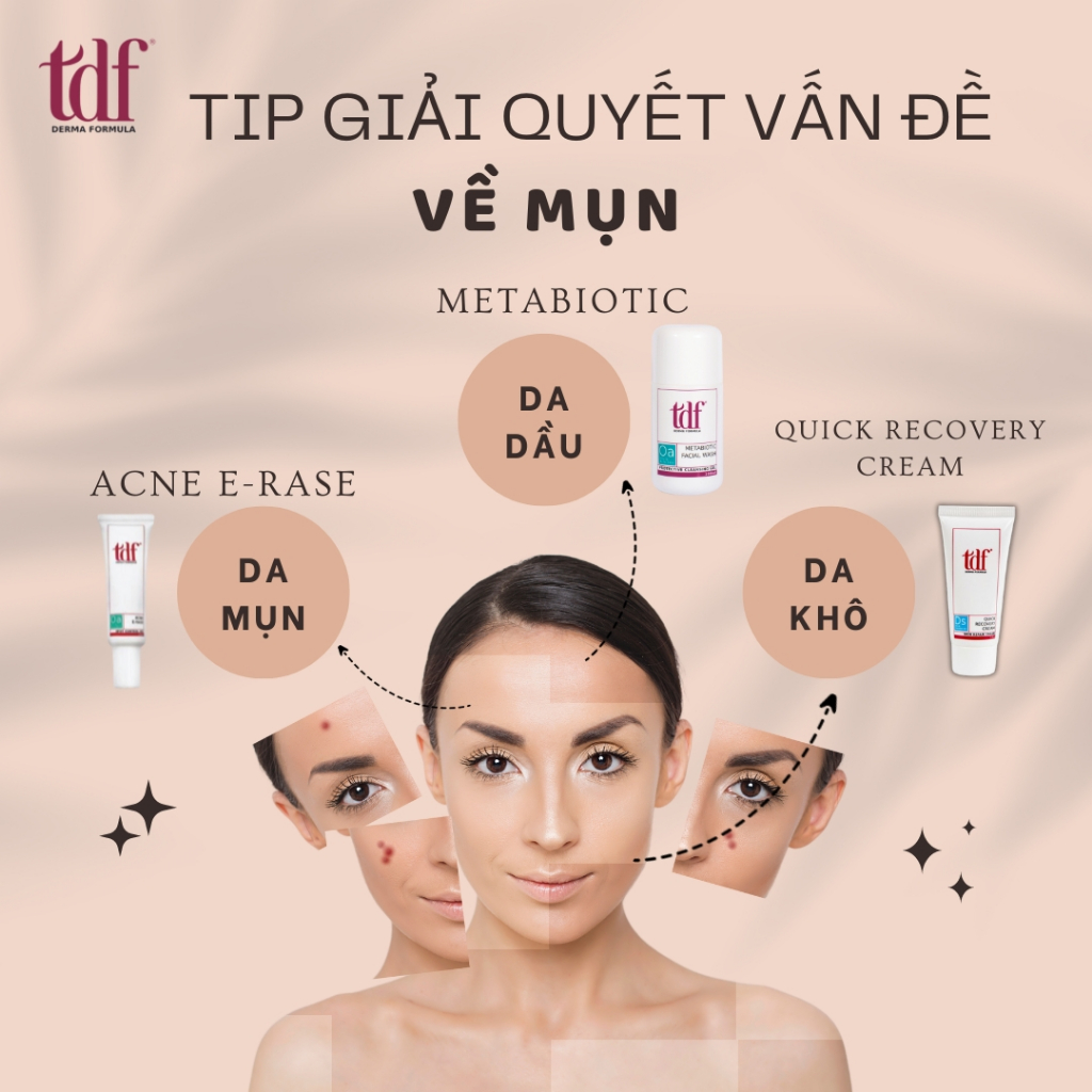 Kem Chấm mụn trứng cá TDF ACNE E-RASE gom còi, làm già còi, sạch mụn ...
