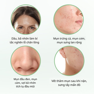 Kem Hết Mụn ZHX Loại Bỏ Mụn và Vết Thâm Hoàn Toàn, Thu Nhỏ Lỗ Chân Lông, Dưỡng ẩm Sáng Da