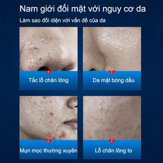 Bộ chăm sóc da mặt nam sữa rửa mặt nam giớI sạch mụn kiềm dầu dưỡng ẩm cho làn da