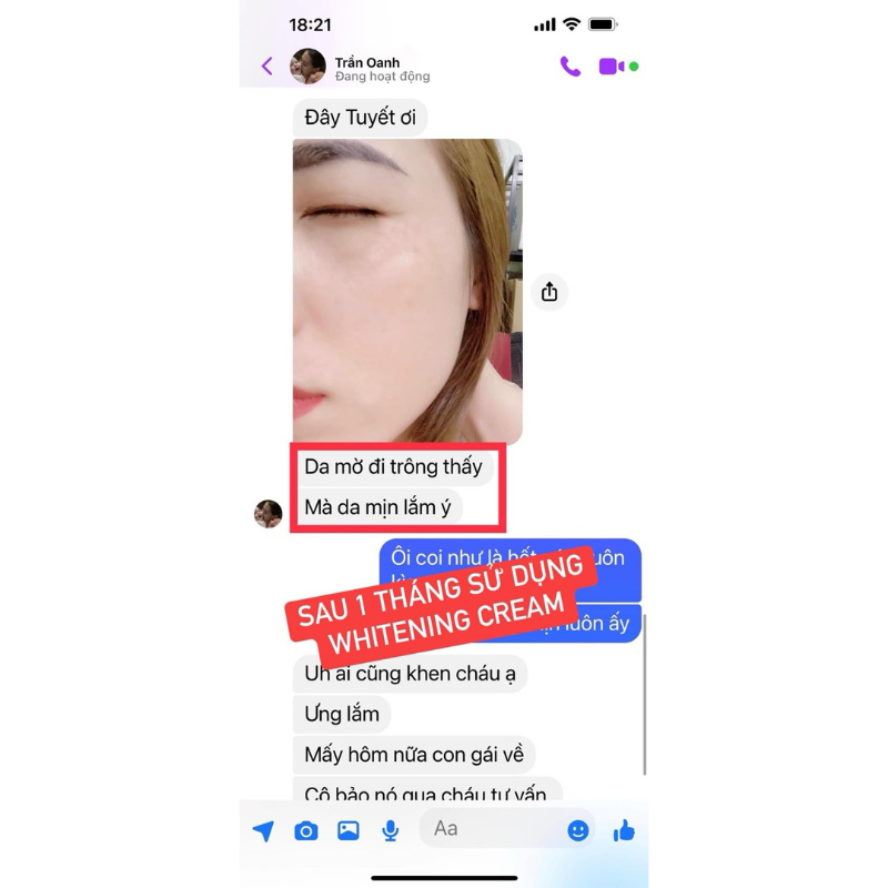 kem dưỡng trắng da mờ thâm nám tàn nhang WHITENING CREAM 5g giúp da căng mịn ngăn ngừa lão hóa da