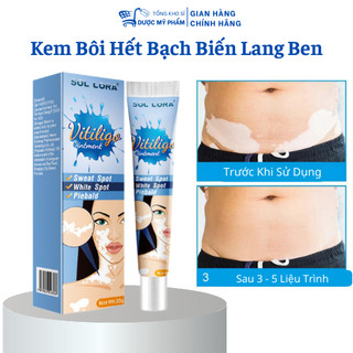 Kem Hết Bạch Biến, Đanh Bay Lang Ben, Phục Hồi Cho Da Đều Màu Loại Bỏ Các Đốm Trắng
