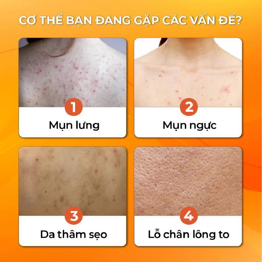 Sữa tắm gừng nghệ hữu cơ cocayhoala giúp giảm và tạm biệt mụn lưng chai 500g