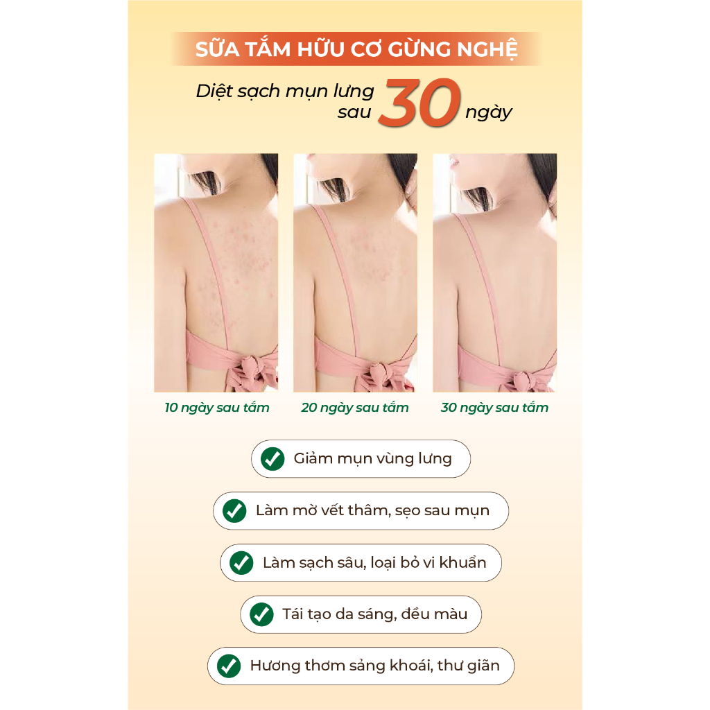 Sữa tắm gừng nghệ hữu cơ cocayhoala giúp giảm và tạm biệt mụn lưng chai 500g