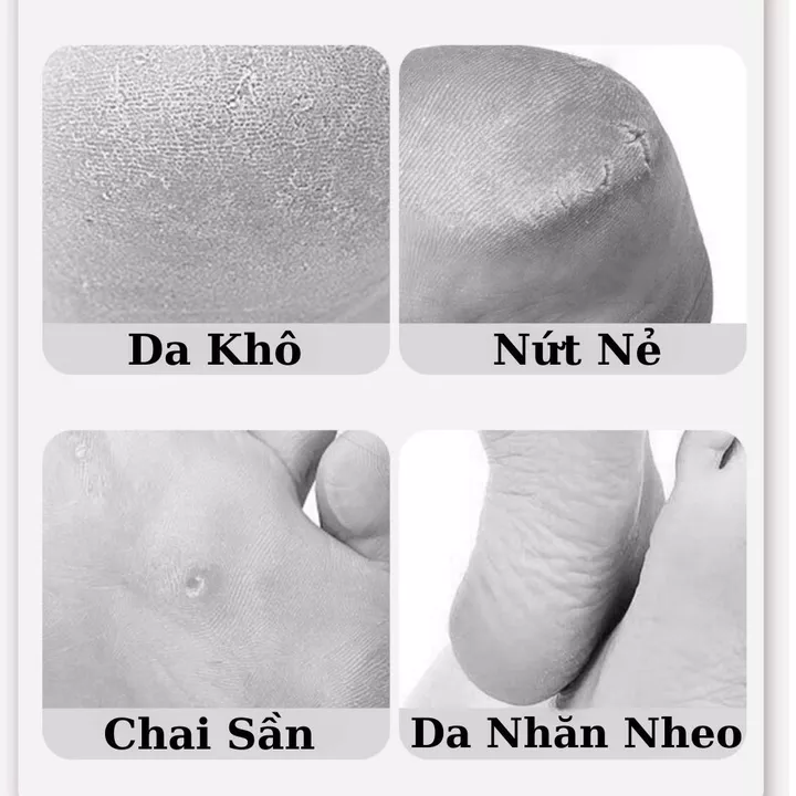 Tất Ủ Chân Silicon Ủ Kem Dưỡng Ẩm Chống Khô Da Nứt Nẻ Gót, Vớ Ủ Chân Giúp Bảo Vệ Da Dưỡng Trắng Mềm Da
