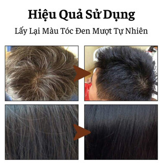 Combo Dầu Gội Xả Nấm Linh Chi Đen Nuôi Dưỡng Tóc Chắc Khỏe Tận Gốc Ngăn Ngừa Gãy Rụng Lấy Lại Màu Tóc