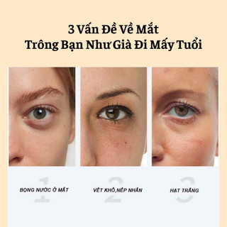 Gel Lăn Massage Mắt Hết Khô Sạm Xóa Nhăn Mờ Quầng Thâm Hết Chảy Xệ