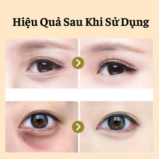 Gel Lăn Massage Mắt Hết Khô Sạm Xóa Nhăn Mờ Quầng Thâm Hết Chảy Xệ