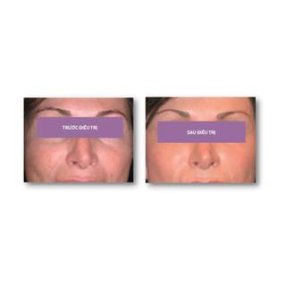 Md:ceuticals md:cocktail Skinbooster Anti-Age Peptide-GF – Tính chất tái sinh làn da, chống oxy hóa