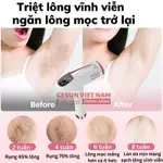 Máy Triệt Lông Lạnh IPL 999.999 Xung Công Nghệ Triệt Lạnh 10°C – 9 Cấp Độ – Giải Pháp An Toàn Cho Làn Da Mịn Màng — ảnh 4