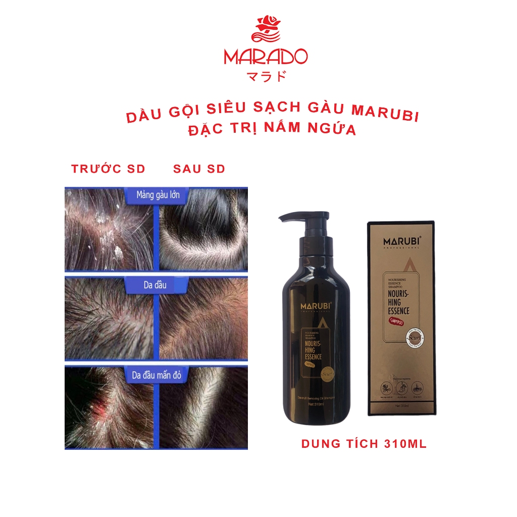 Dầu Gội Marubi siêu sạch gàu 310ml làm sạch gàu da dầu nấm ngứa