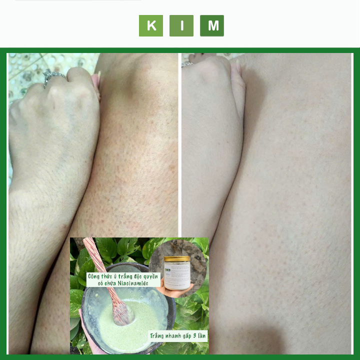Bột ủ trắng Niacinamide độc quyền Spa tắm trắng thuần chay homemade Kim - Thuần Thiên Nhiên trắng da dưỡng da nâng tone