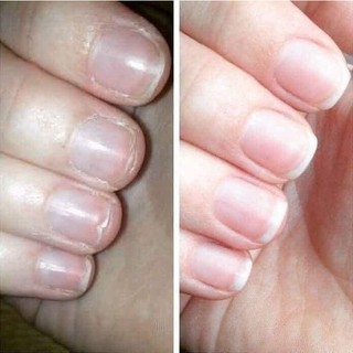 [Mẫu Mới] Dưỡng Móng Collagen Thiên Di  Giúp Móng Cứng Và Nhanh Dài Phục Hồi Móng Yếu Và Hư Tổn Dùng Chăm Sóc Móng