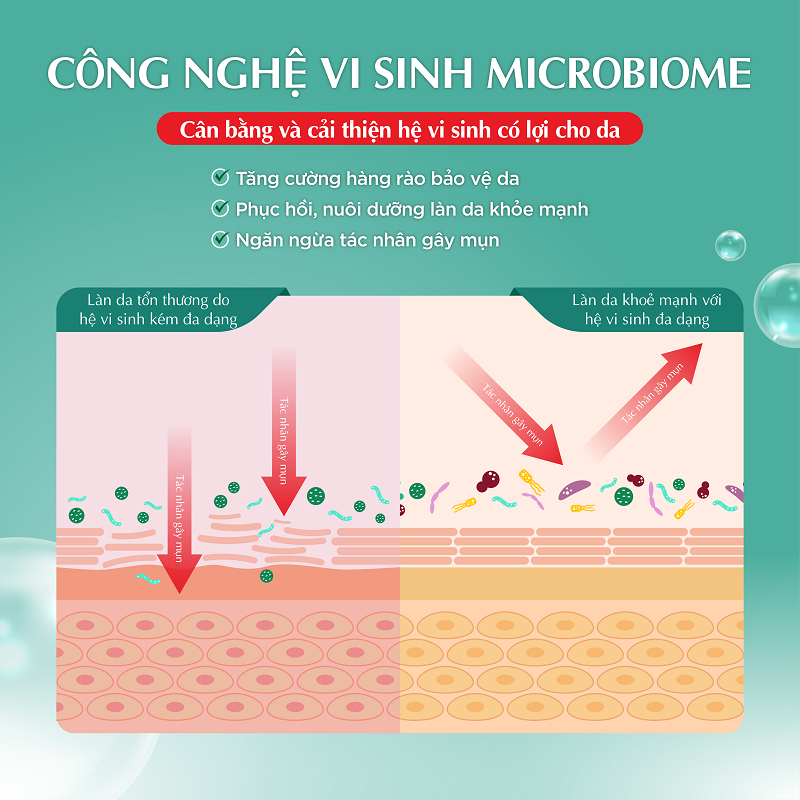 Ảnh Gel dưỡng ẩm cho da mụn, nhạy cảm Hada Labo Acne Care Calming Gel Cream 50g 4