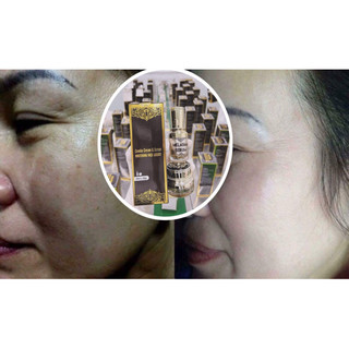 BỘ NÁM TRẮNG DA CAO CẤP