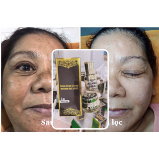 BỘ NÁM TRẮNG DA CAO CẤP