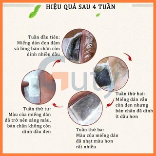 COMBO 2 HỘP(100)Miếng Dán Thải Độc Chân Ngải Cứu hộp 50 Miếng Giúp Ngủ Ngon Giảm Nhức Mỏi Thải Độc Chân Thanh Lọc CơThể