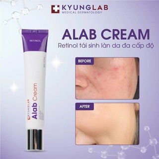 Kem retinol KYUNGLAB Alab Cream giảm nếp nhắn, chống lão hóa. tiết dầu, ngăn ngừa mụn 30ml