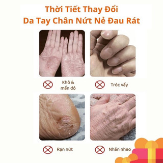 Kem Chống Nẻ - Kem Dưỡng Ẩm Chống Nứt Nẻ Da Heyxi 20g