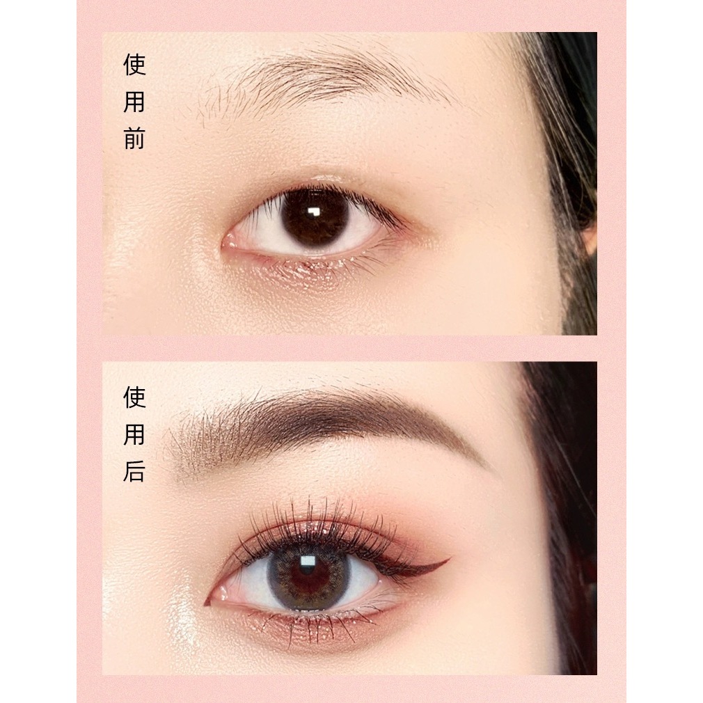 Kích Mí, Kích Mí Lưới, kích mí tàng hình, Miếng Dán Kích Mí - XIXI GJ24