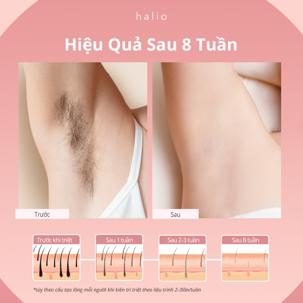 Ảnh [SPLIVE] Máy Triệt Lông Băng Lạnh Trẻ Hóa Da Halio IPL Cooling Hair Removal Device 4