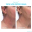 Bộ (4 sp) Skinfix chăm sóc da, dưỡng ẩm:Sữa rửa mặt+Kem cân bằng+Serum cân bằng+Kem dưỡng mắt :Skinfix Barrier+ Besties