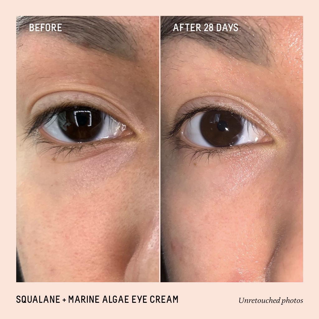 Kem Dưỡng Mắt Biossance Squalane + Marine Algae Firming & Lifting Eye Cream - Size: 15 mL Skincare