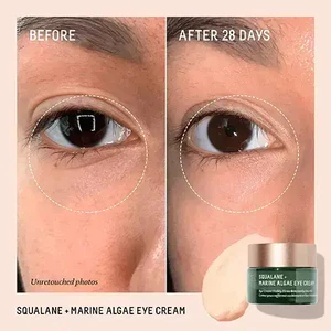 Kem Dưỡng Mắt Biossance Squalane + Marine Algae Firming & Lifting Eye Cream - Size: 15 mL Skincare