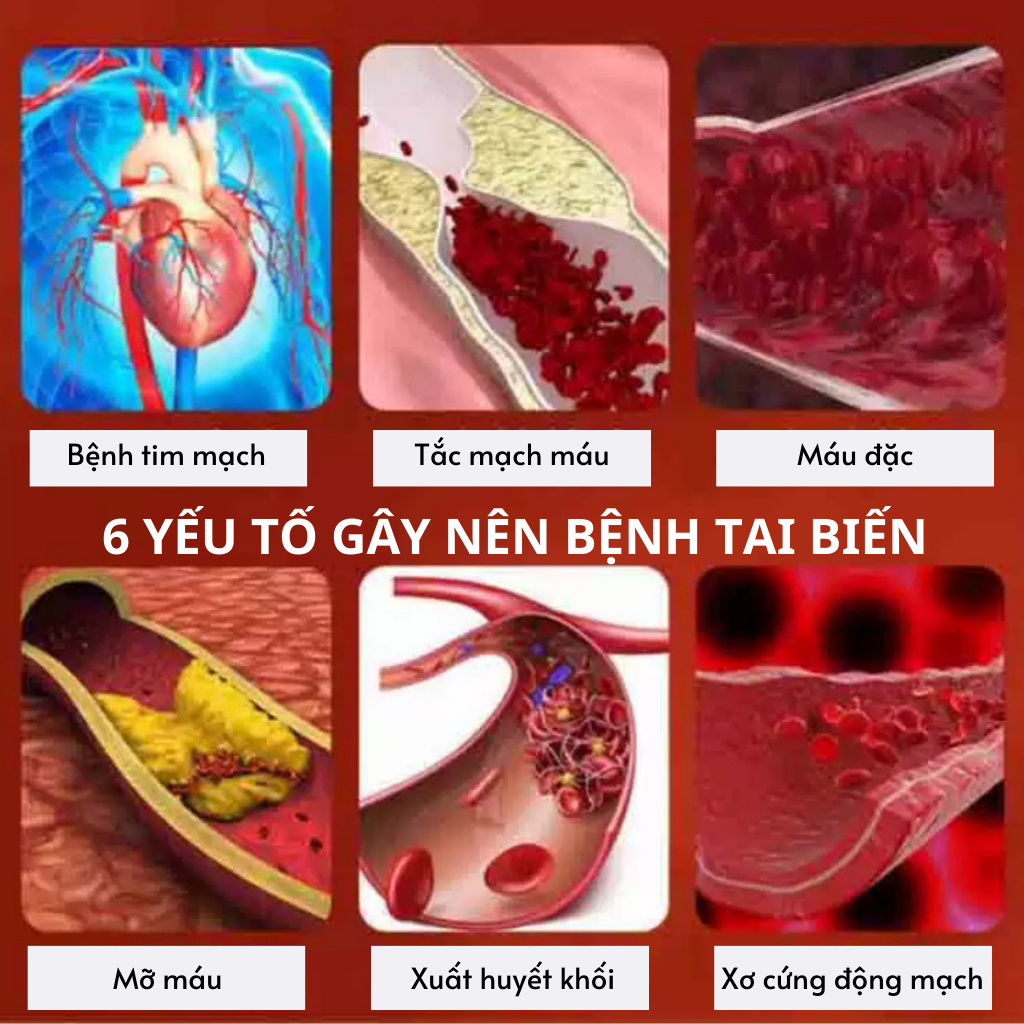 Trà an cung dưỡng não , phòng ngừa đột quỵ, phòng chống nguy cơ đông máu bịch 30 gói lọc