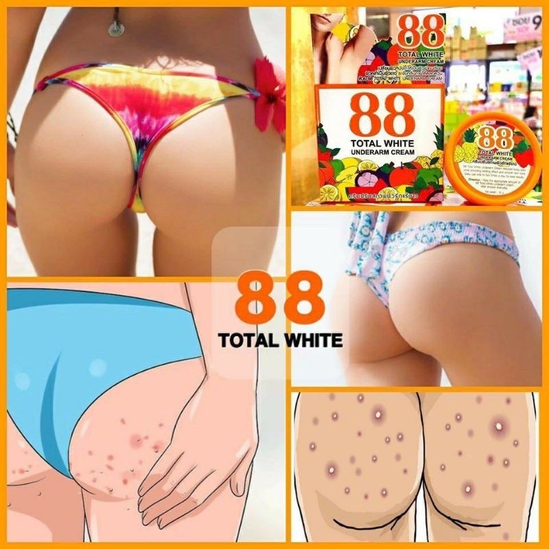 Kem giảm thâm nách Total White 88 35g chính hãng Thái Lan, giảm thâm bikini
