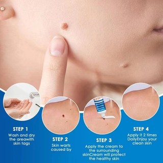 Kem mụn thịt dư cao cấp Sol Lora, Kem tẩy nốt ruồi, mụn thịt dư, nốt ve chó, u mềm treo, South Moon chính hãng