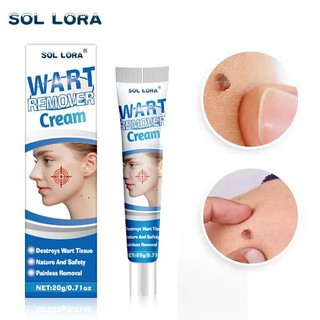 Kem mụn thịt dư cao cấp Sol Lora, Kem tẩy nốt ruồi, mụn thịt dư, nốt ve chó, u mềm treo, South Moon chính hãng
