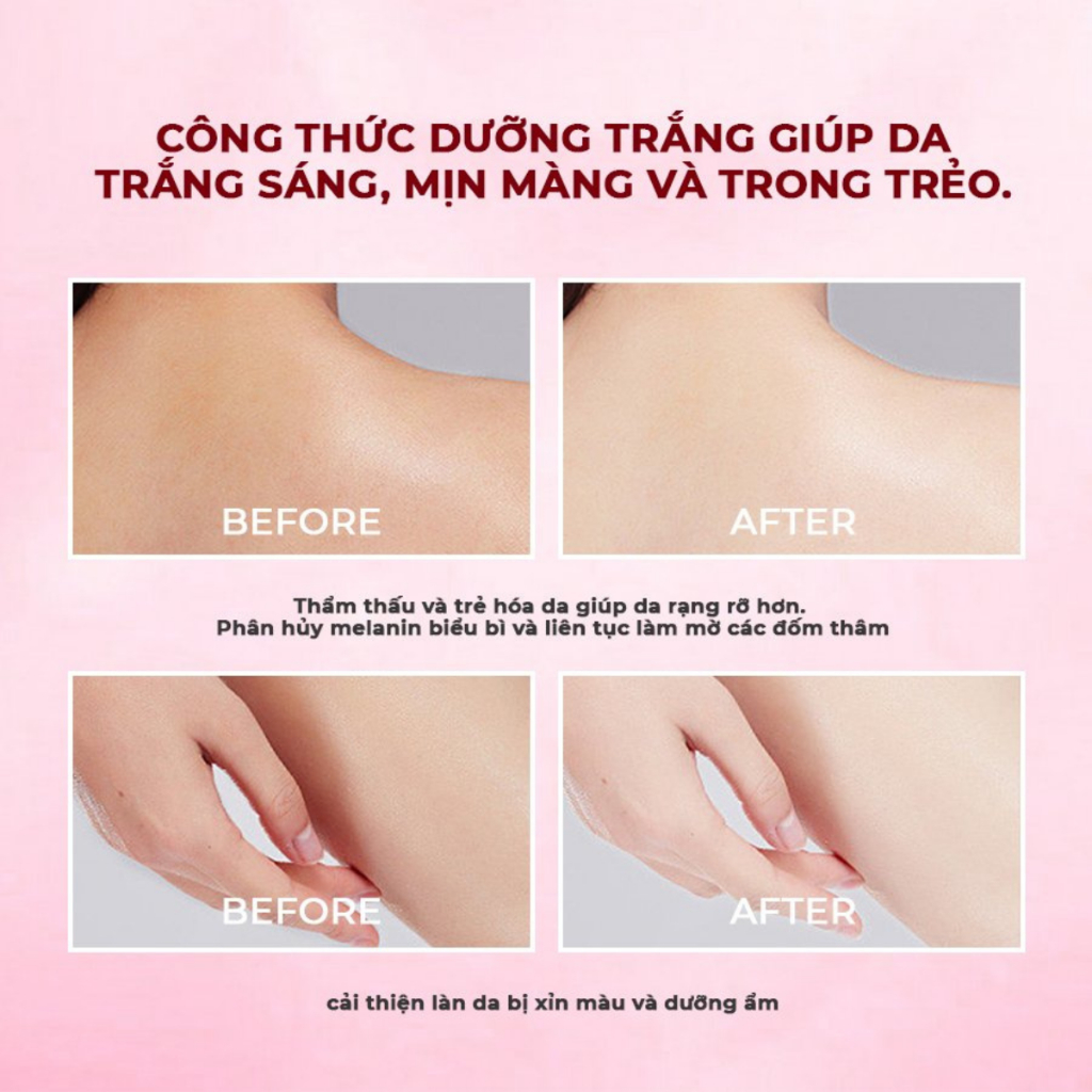 [Date 10/2027]Kem Body KOLAN 150ml, Dưỡng Trắng, Nâng Tone, Chống Nắng, Dưỡng Ẩm, Chống Lão Hóa