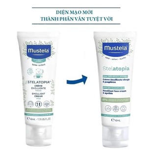Kem Dưỡng Ẩm Mustela Cho Mặt, Da Chàm Thể Tạng (Viêm Da Cơ Địa) Mustela Stelatopia Emollient Face Cream 40ml