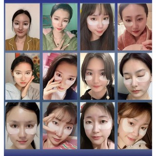 Miếng Dán Pearl Roe Men Loại Bỏ Quầng Thâm Và Bọng Mắt Loại Bỏ Đường Viền Làm Mờ Nếp Nhăn