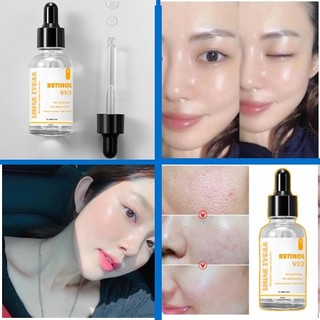 Serum Retinol  Chống Lão Hóa Trắng da, Mờ thâm Làm Giảm Nếp Nhăn Hiệu Quả
