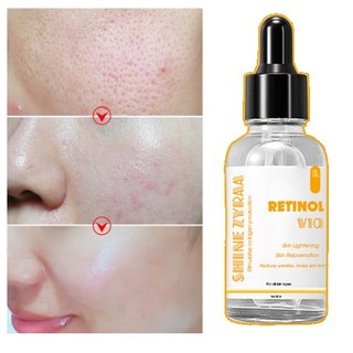 Serum Retinol  Chống Lão Hóa Trắng da, Mờ thâm Làm Giảm Nếp Nhăn Hiệu Quả