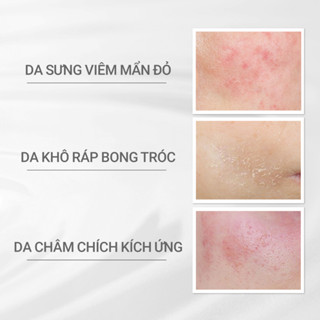 Kem dưỡng Phục hồi da dProgram Skin Repair Cream 45g | Shopee Việt Nam