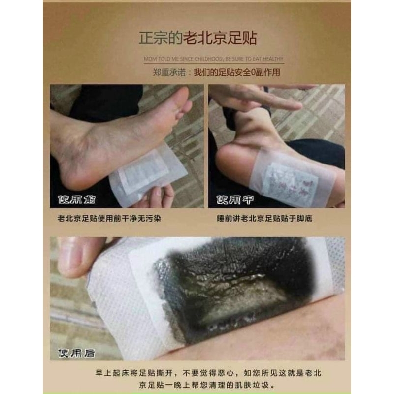 MIẾNG DÁN CHÂN NGẢI CỨU THẢI ĐỘC BẮCKINH