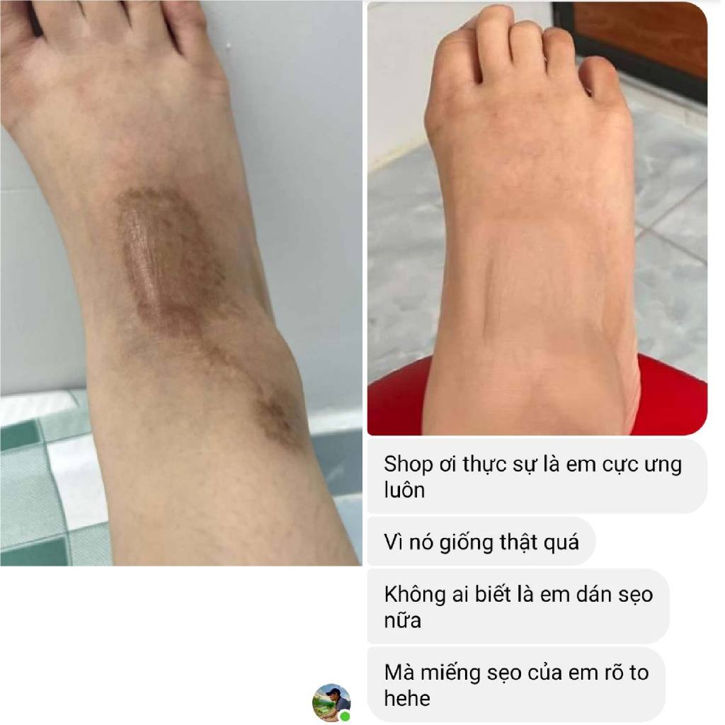 Miếng dán che sẹo hình xăm mụn khuyết điểm sẹo lồi nốt ruồi đậm màu Bellena XS2