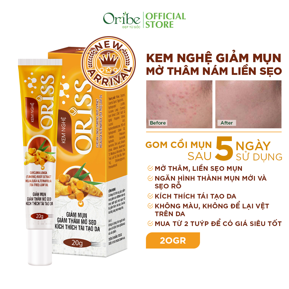 Ảnh Combo kem chấm mụn Oribe & kem nghệ Oriss giúp giảm mụn mờ thâm 3