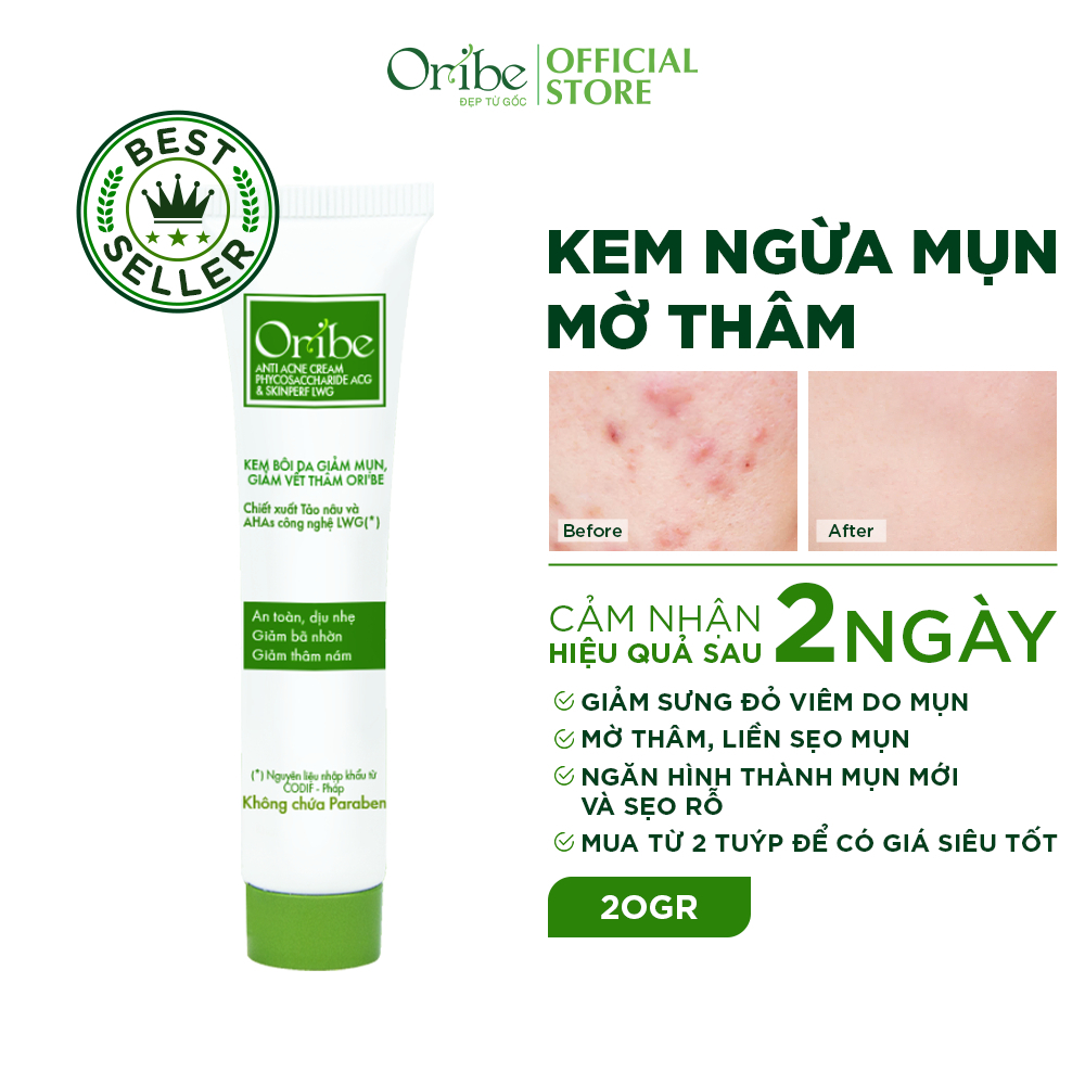 Ảnh Combo kem chấm mụn Oribe & kem nghệ Oriss giúp giảm mụn mờ thâm 4