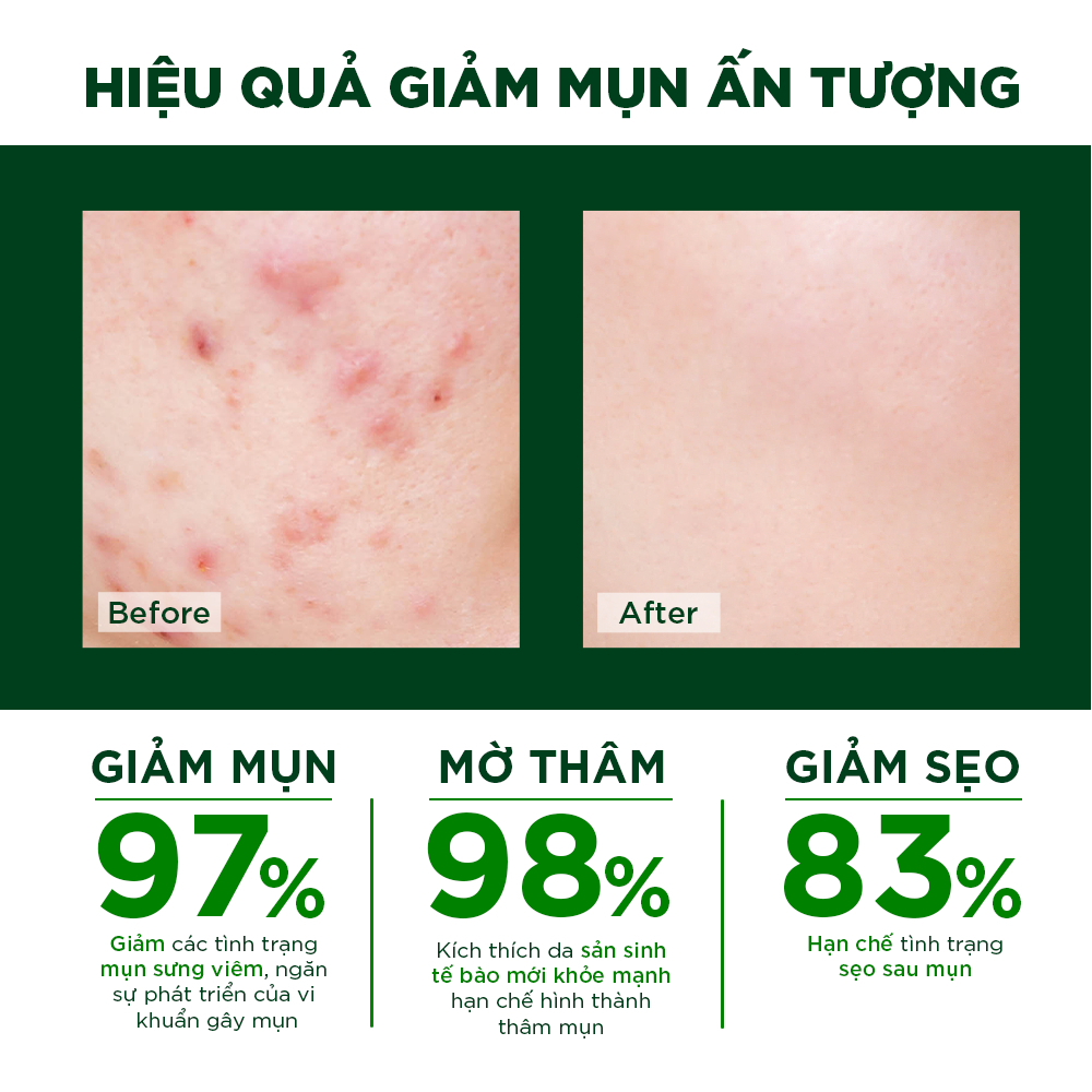 Ảnh Combo kem chấm mụn Oribe & kem nghệ Oriss giúp giảm mụn mờ thâm 2